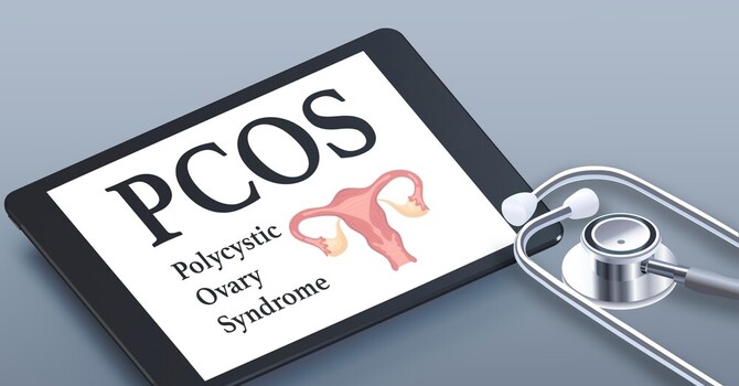 More than just polycystic ovaries